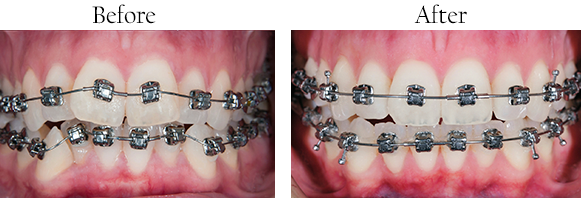 Saugus Dental Images