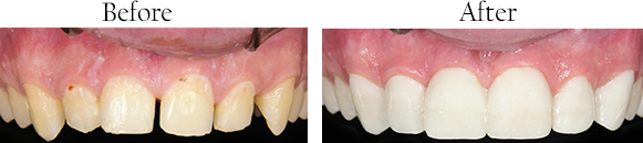 Dental Images 01906